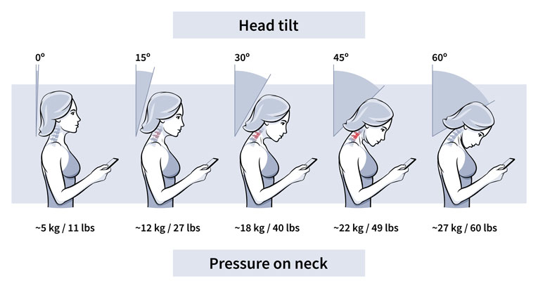 Health Tip ; Tension Neck Syndrome