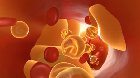 CholesterolGeneticsClinicalTrial.jpg